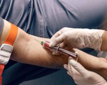 9 Benefits of Jason Health for Easy Lab Testing!