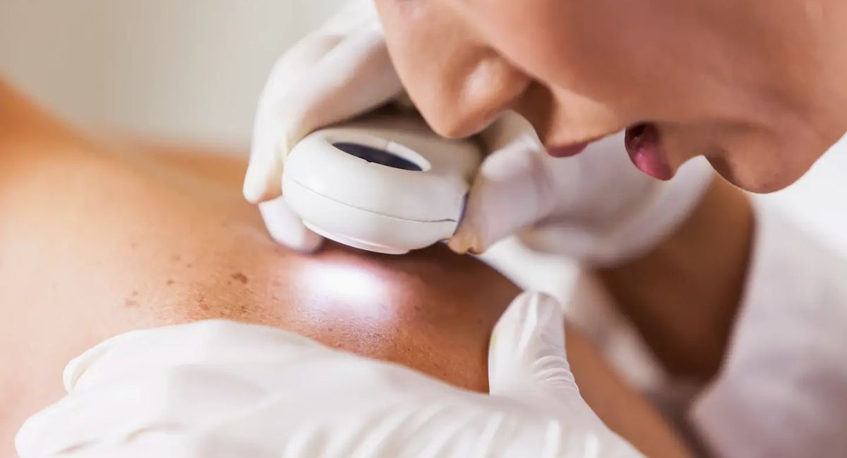 Dermatology Skin Care Peabody - 2 Your Complete Local Guide!