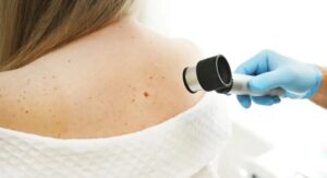 Skin Cancer Detection at Dermatology Skin Care Peabody Clinics