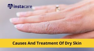 Understanding Why Dry Skin Needs Extra Care