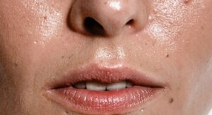 Understanding Oily Skin and Sebum Production