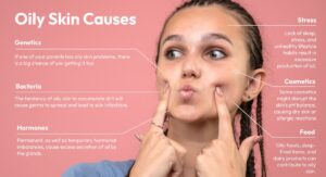 Understanding Oily Skin and Its Causes
