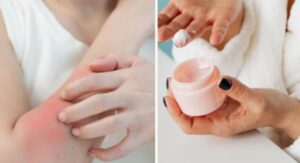 Role of Fragrance-Free Products in Sensitive Skin Care