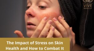 Stress Management and Sensitive Skin Health