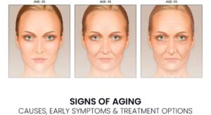 Understanding Skin Aging and Its Early Signs