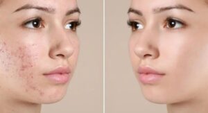 Understanding the Core Science Behind Advanced Skin Care