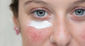Expert Tips for Using Anti Inflammatory Skin Care Products