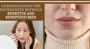 Understanding Sensitive Skin and Its Challenges