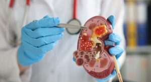 Chronic Disease Management Requires Consistent Medical Support