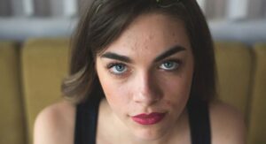 Understanding What Causes Excess Facial Oil