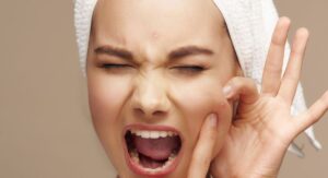 Common Mistakes People Make With Acne Treatment