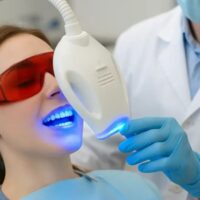 17 Cosmetic Dentist Treatments for a Stunning Smile!
