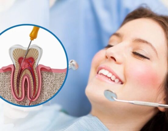 Root Canal Treatment - Saving Your Natural Tooth