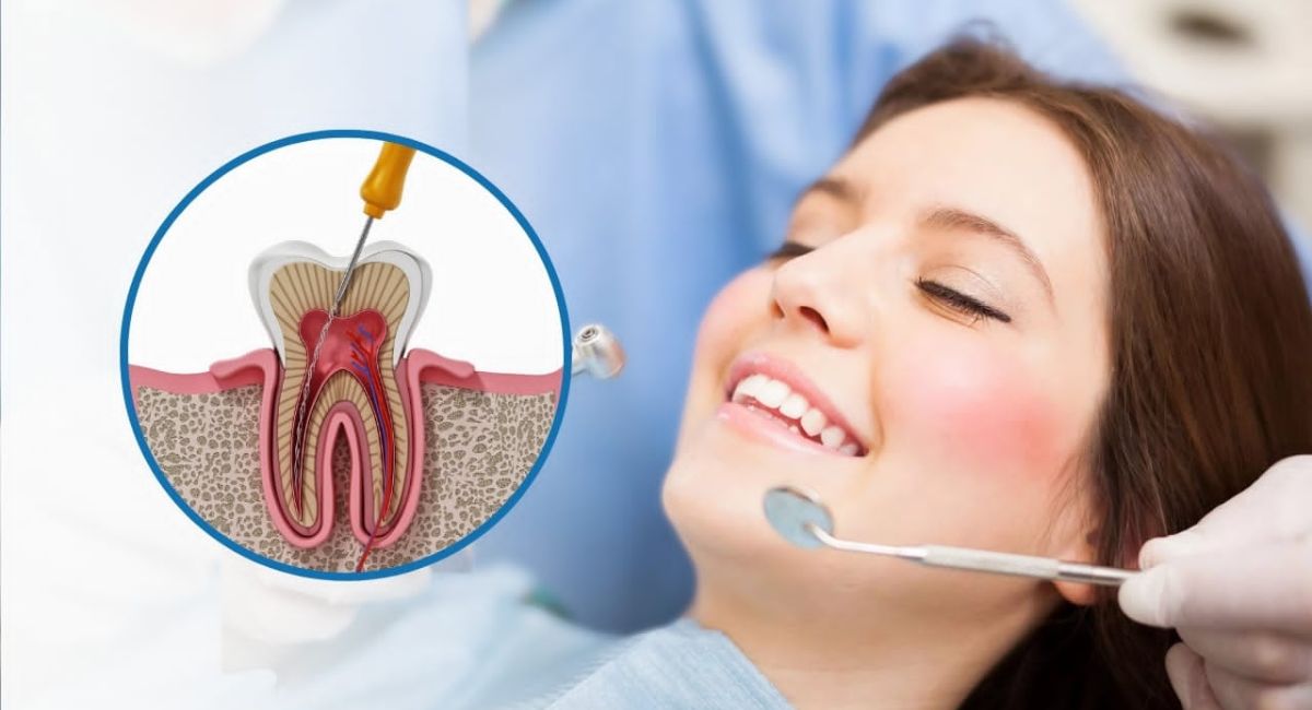 Root Canal Treatment - Saving Your Natural Tooth