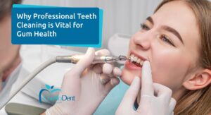 Benefits of Professional Gum Cleaning