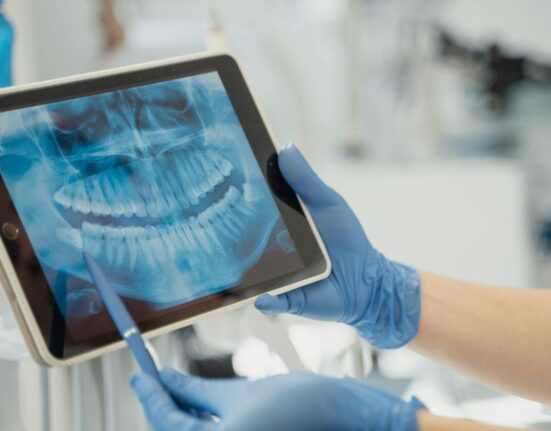 Weekend Dentist Near Me - 3 Quick Ways to Find One!