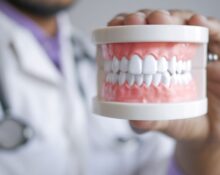 Delta Dental plans - 4 Smart Tips Before You Enroll!