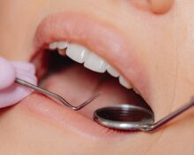Dental Fillings Near me Omaha - 5 Smart Questions!