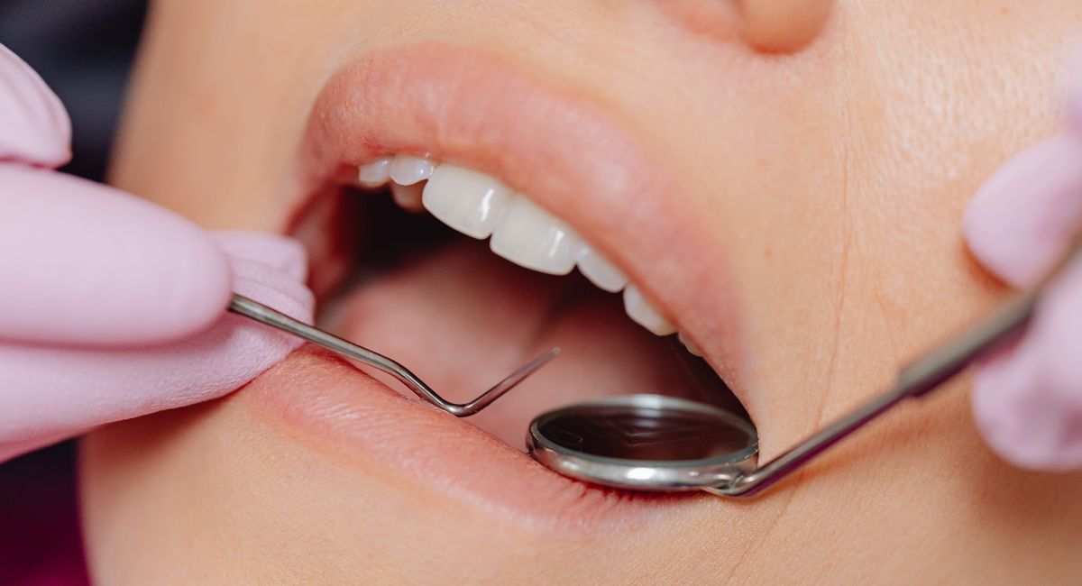 Dental Fillings Near me Omaha - 5 Smart Questions!