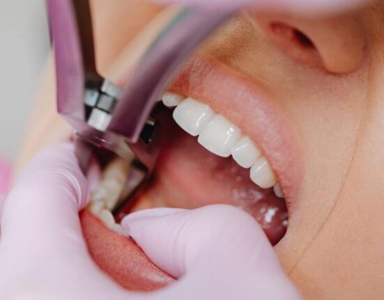 Wisdom Tooth Extraction Dentists: 8 Questions to Ask