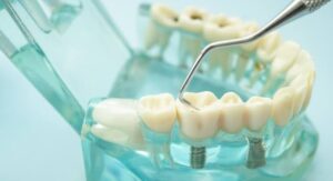 Why Choosing the Right Dental Provider Matters