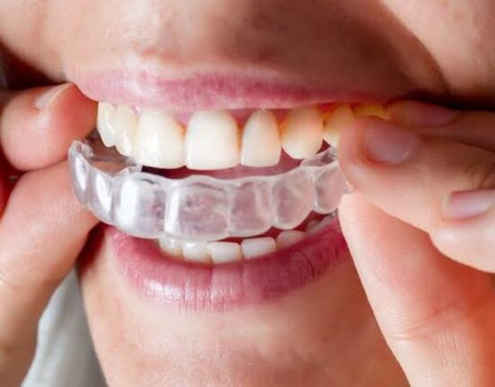 Invisalign Dentist: 7 Things to Look for Before You Choose